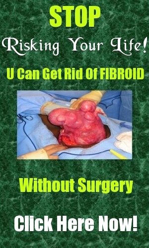 Fibroid Diet Pdf