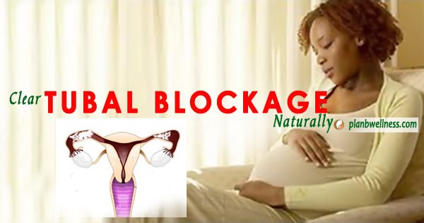 TUBAL BLOCKAGE – NATURAL TREATMENT FOR FALLOPIAN TUBE BLOCKAGE